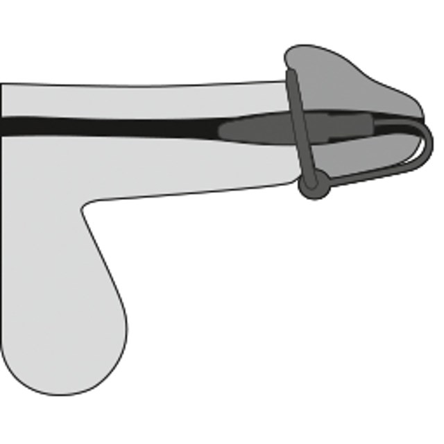 Glans Ring and Dilator